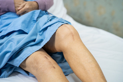 The 7 Best Ways To Take Care Of Your Healing Incision Scar