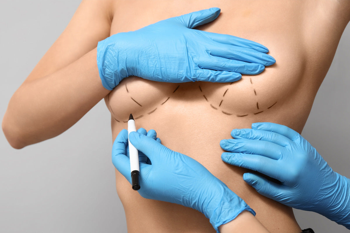 breast augmentation incision scars 5 mistakes that make them worse koaak