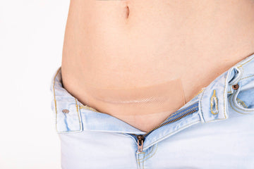 Best C-Section Scar Treatment After 6 Weeks: A Step-By-Step At-Home Protocol