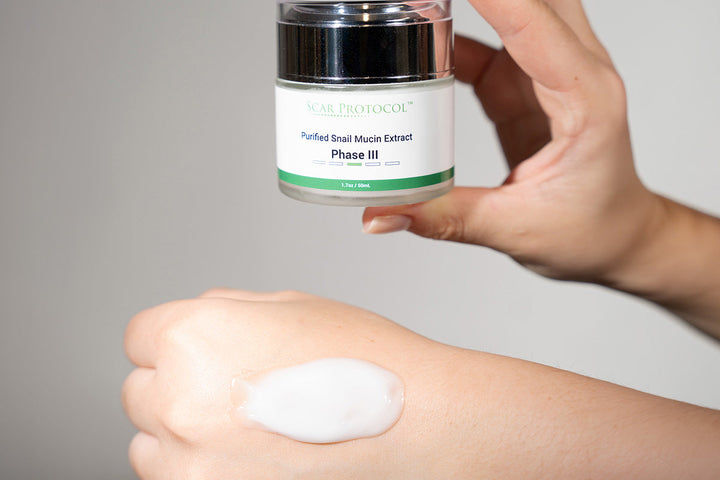Why Consistency Matters: The 90-Day Scar Cream Challenge