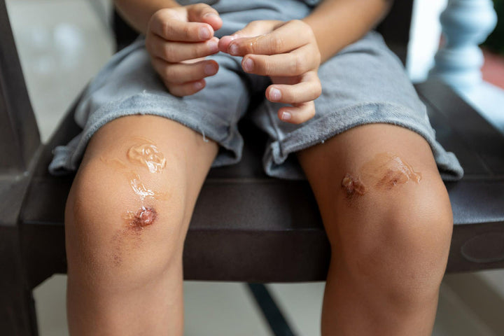 winter vs summer scar care seasonal tips for optimal healing