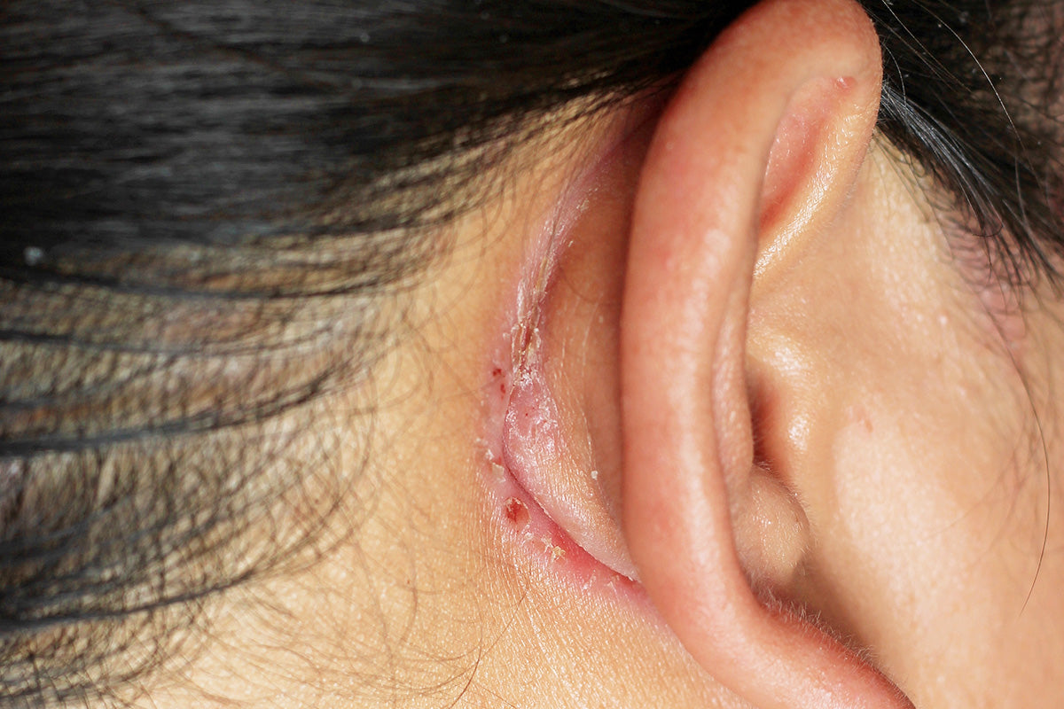 laser vs topical scar treatments  cost downtime results