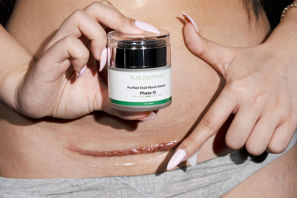 Best Scar Cream After Surgery (Post-Surgery Scar Cream & Expert Tips)