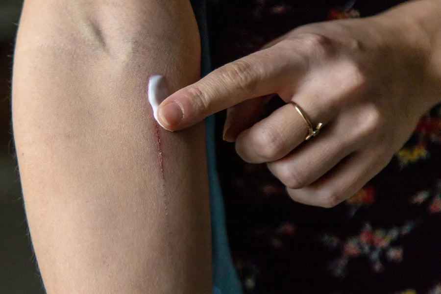 Silicone in Scar Creams: Why It’s the Gold Standard Ingredient