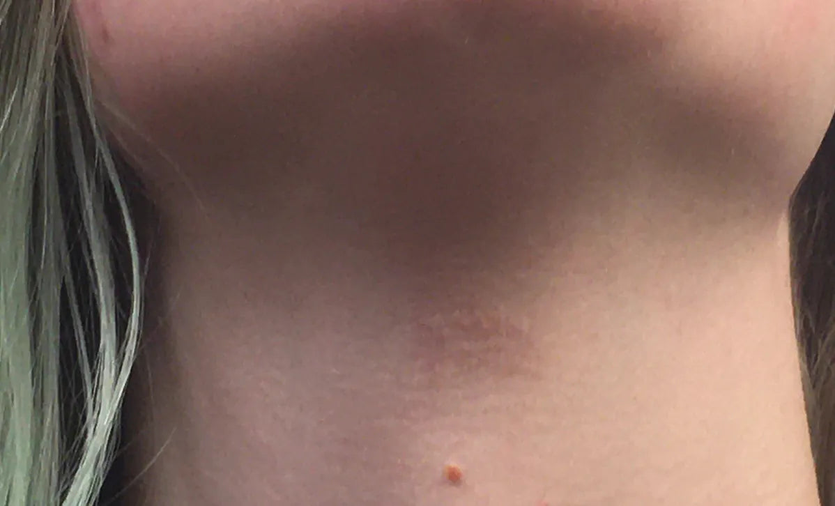 After