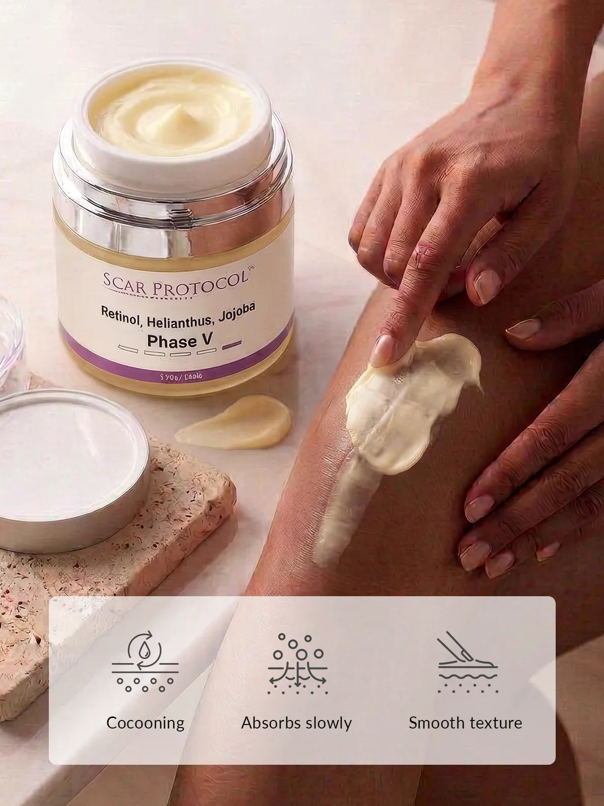 Phase V: Ointment
